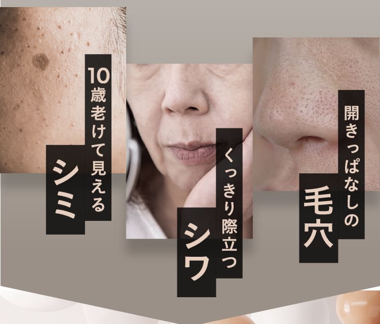 毛穴 シワ シミ